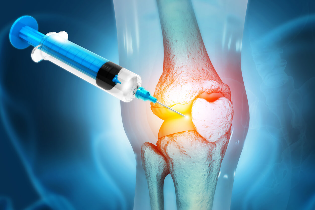 Knee Joint Injections for Knee Pain, Dr Gerard Ee, Singapore