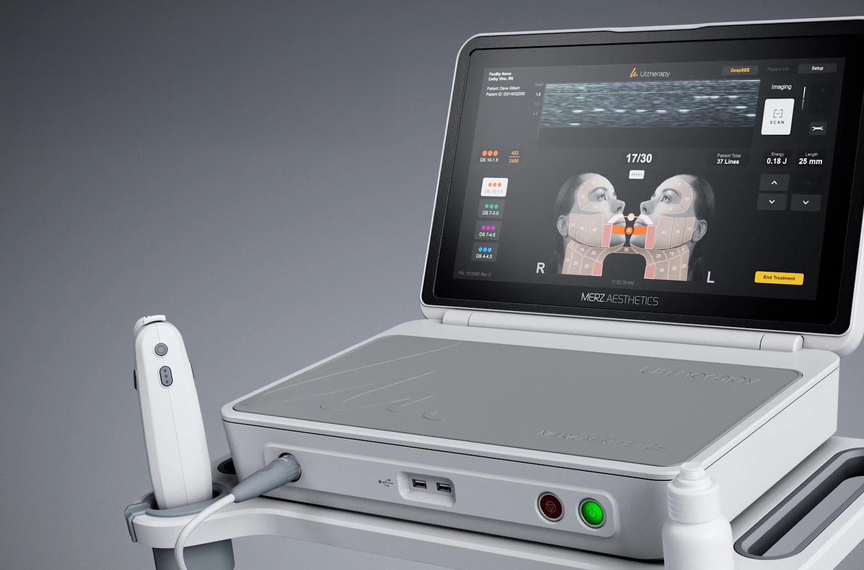 ultherapy Singapore 4