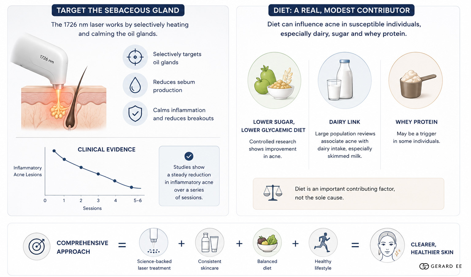 Acne diet Acne diet