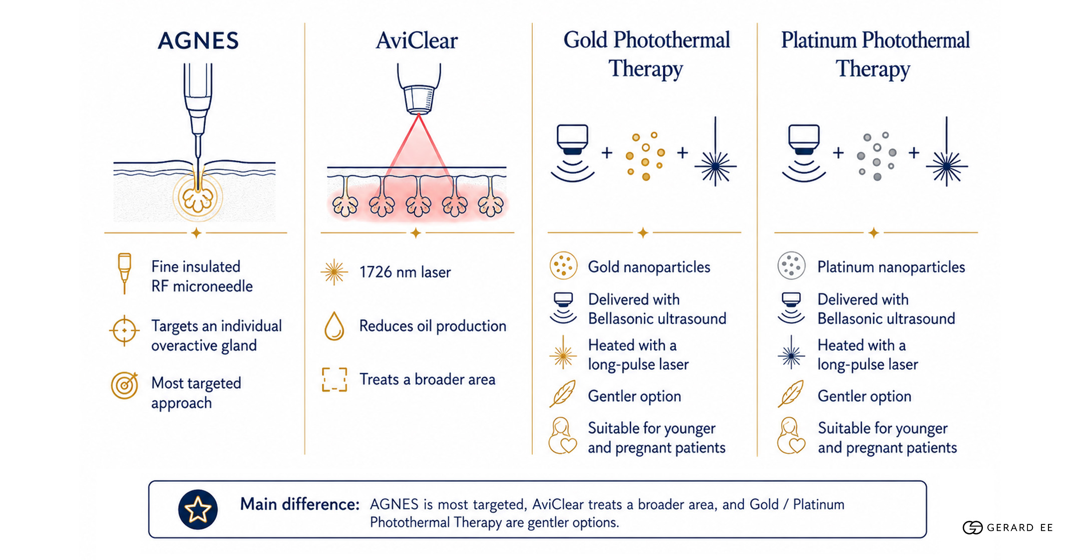 Difference aviclear agnes Difference aviclear agnes