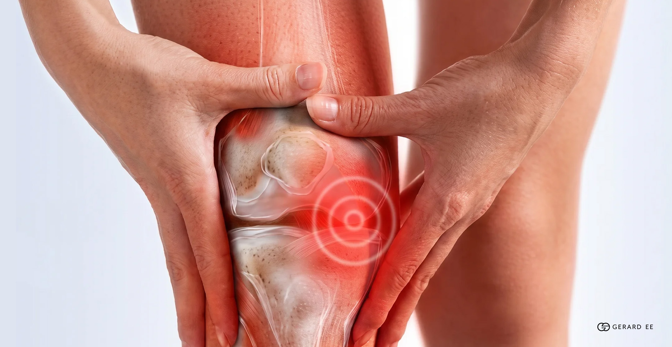 Medial Knee Pain Medial Knee Pain