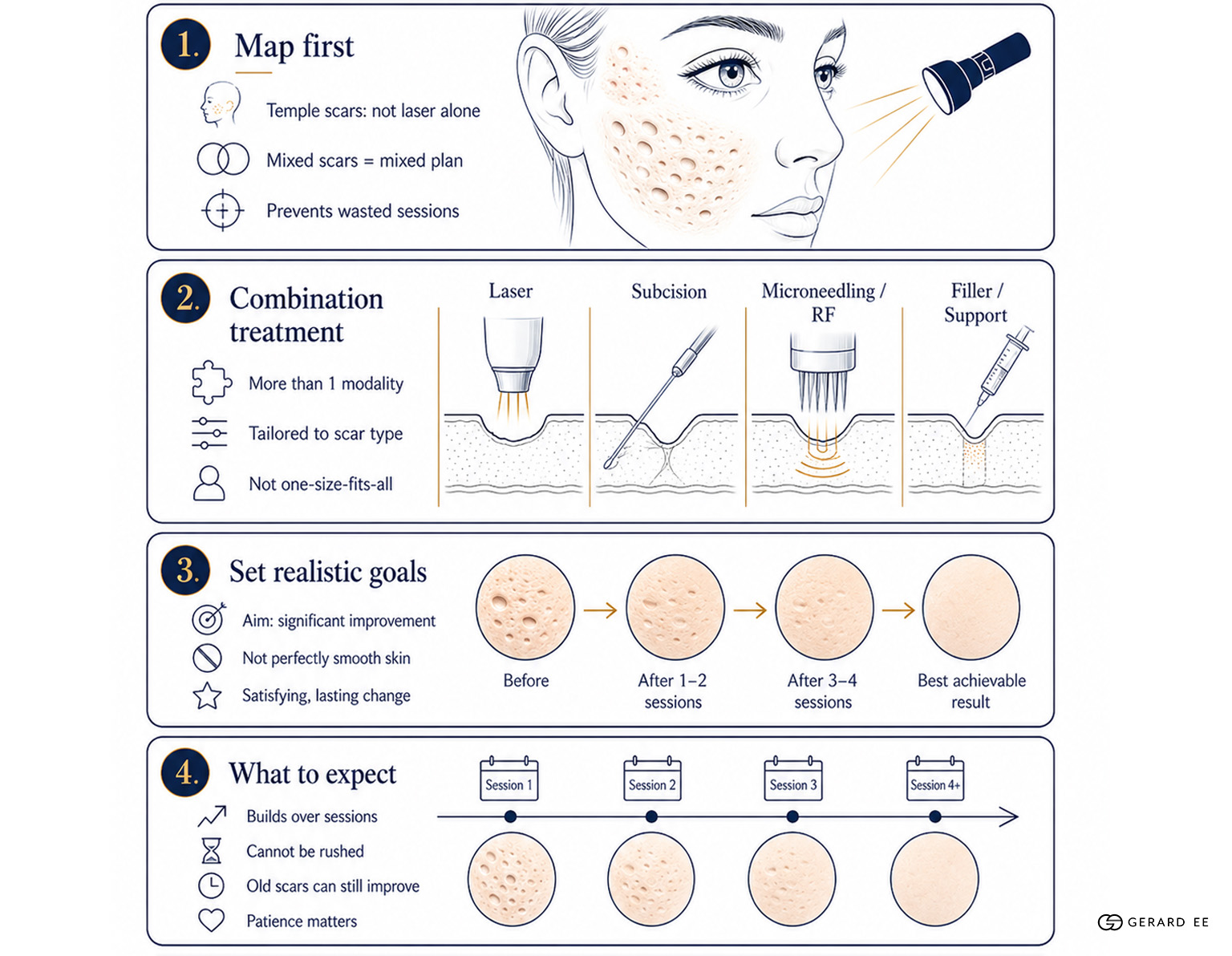 acne scar mapping