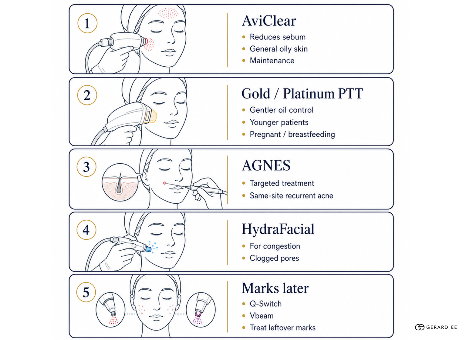 acne treatments dge acne treatments dge