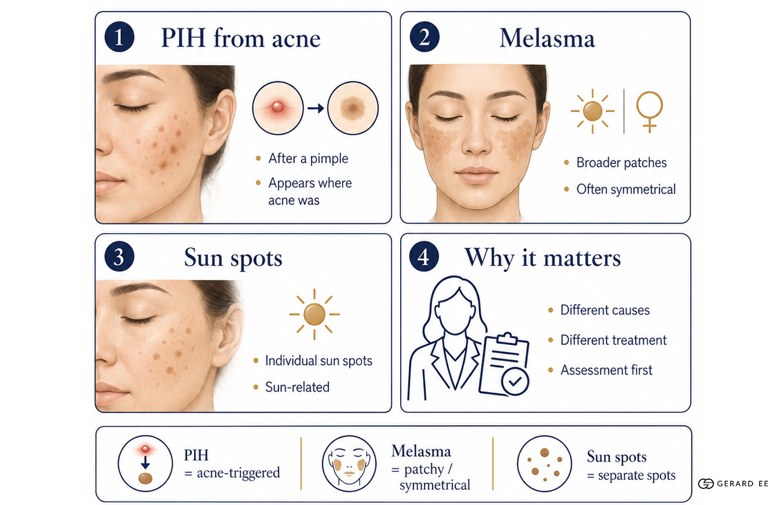 difference between sunspots melasma