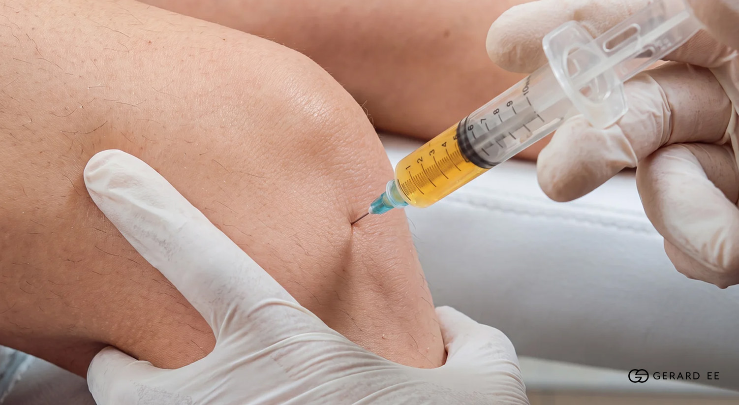 knee injection dr gerardee