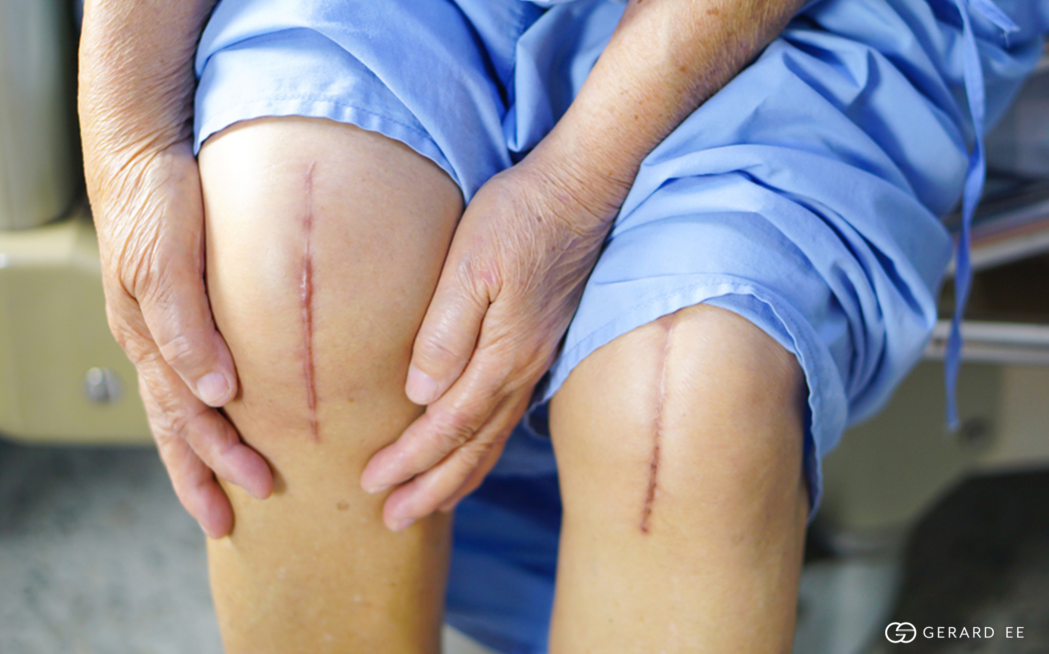 knee surgery dge knee surgery dge