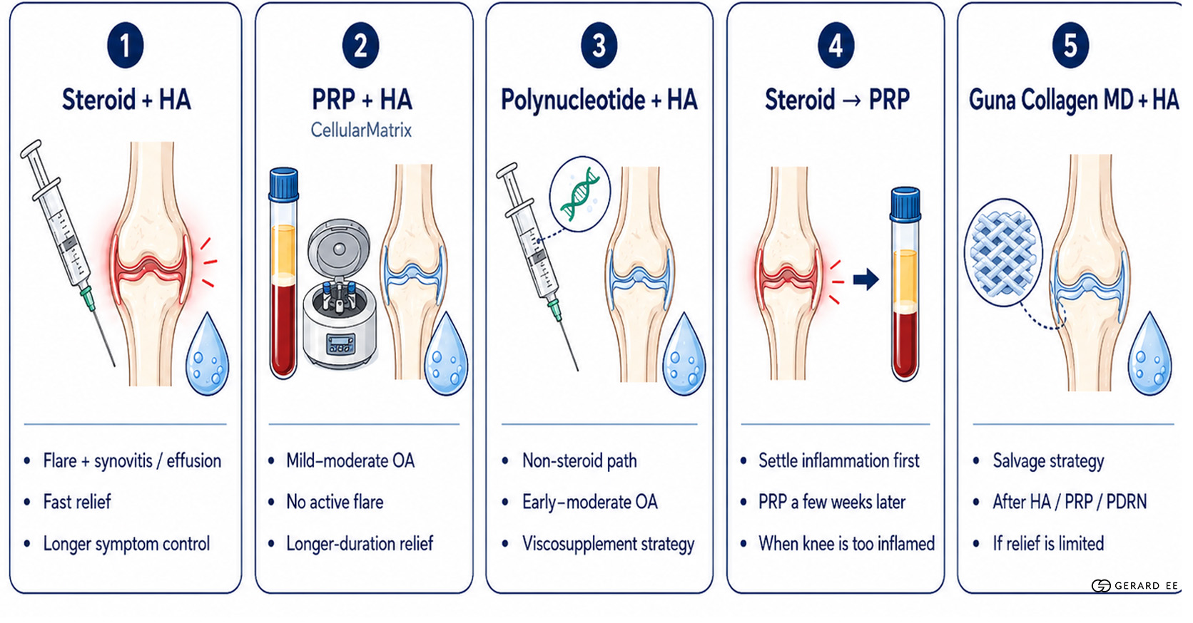 knee treatment options knee treatment options