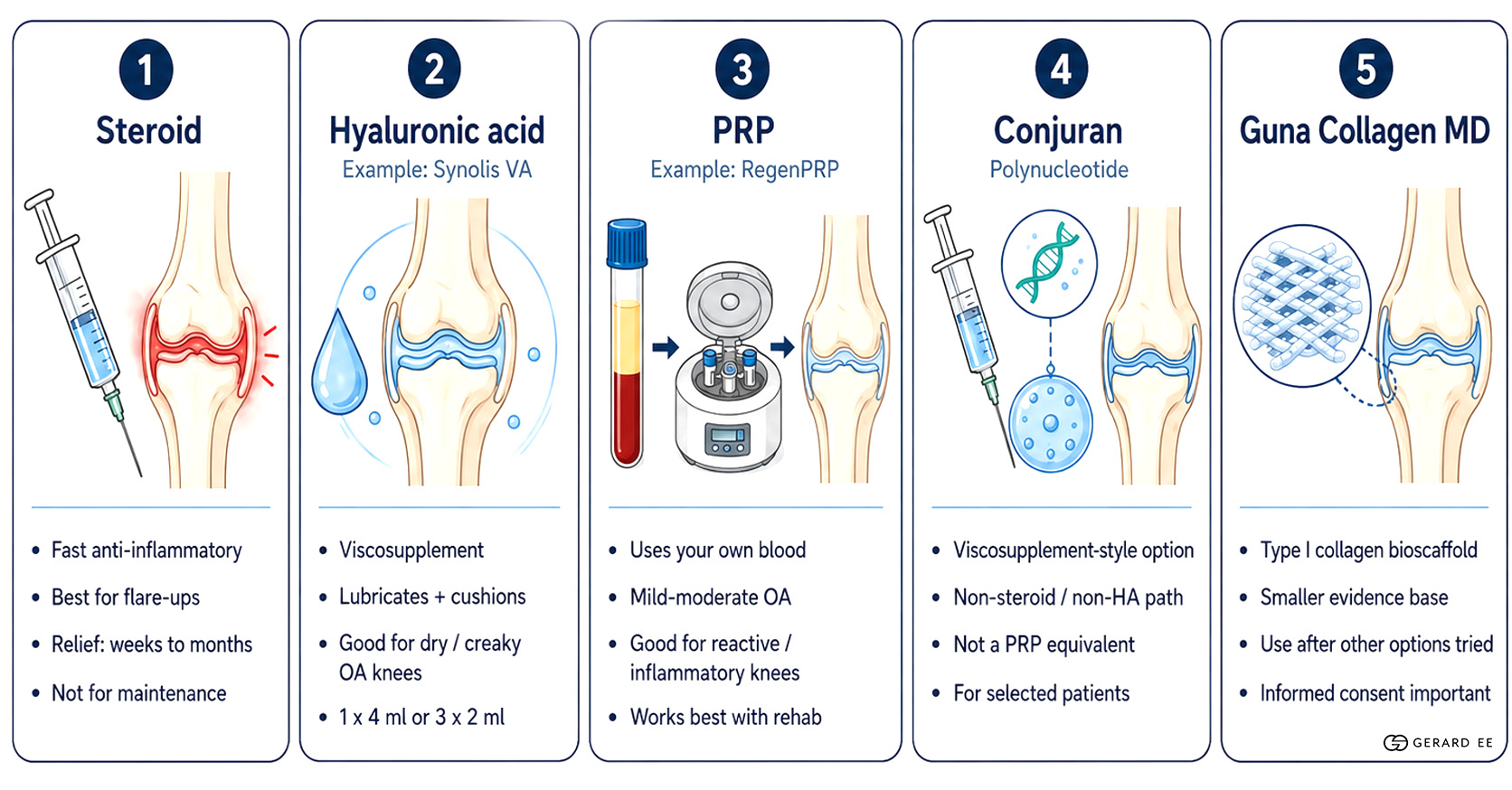 knee treatment options 2 knee treatment options 2
