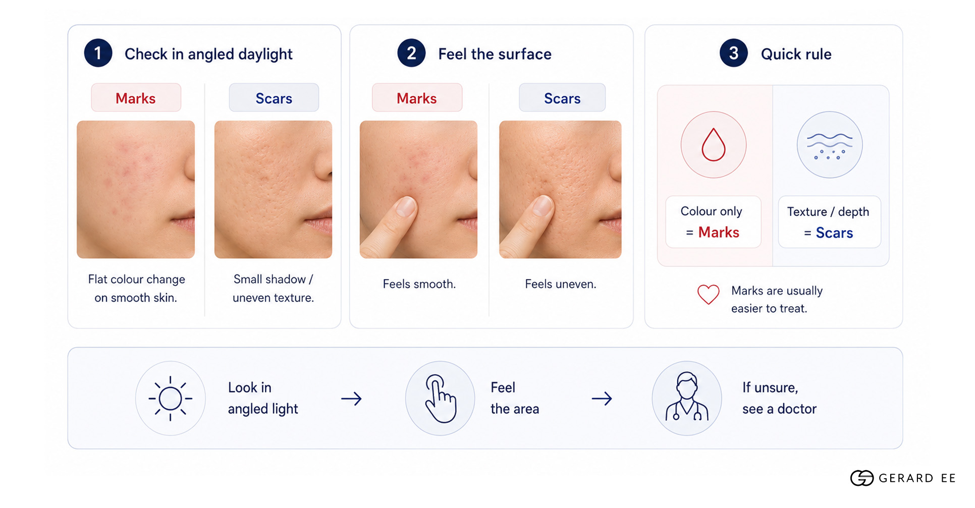 marks or scars diagram marks or scars diagram