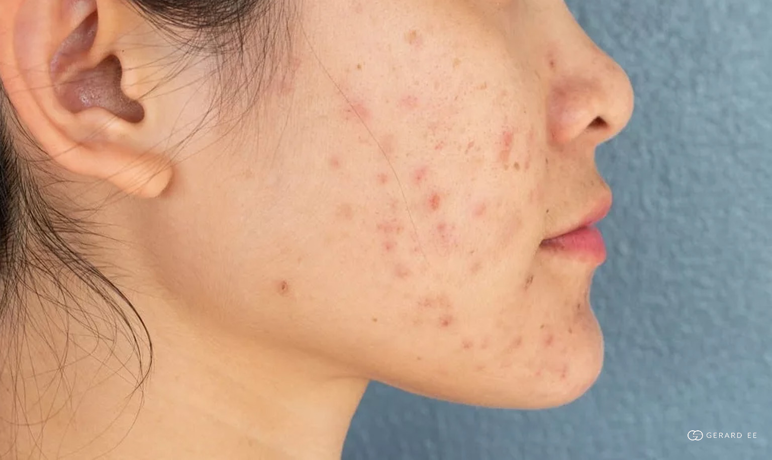red brown spots