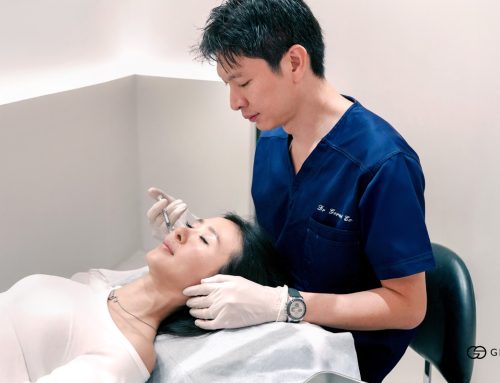 Acne Scar Treatment Cost in Singapore