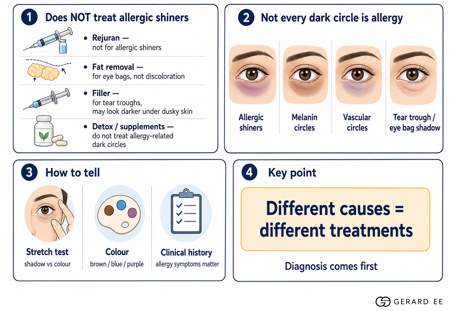 What does not work for allergic shiners