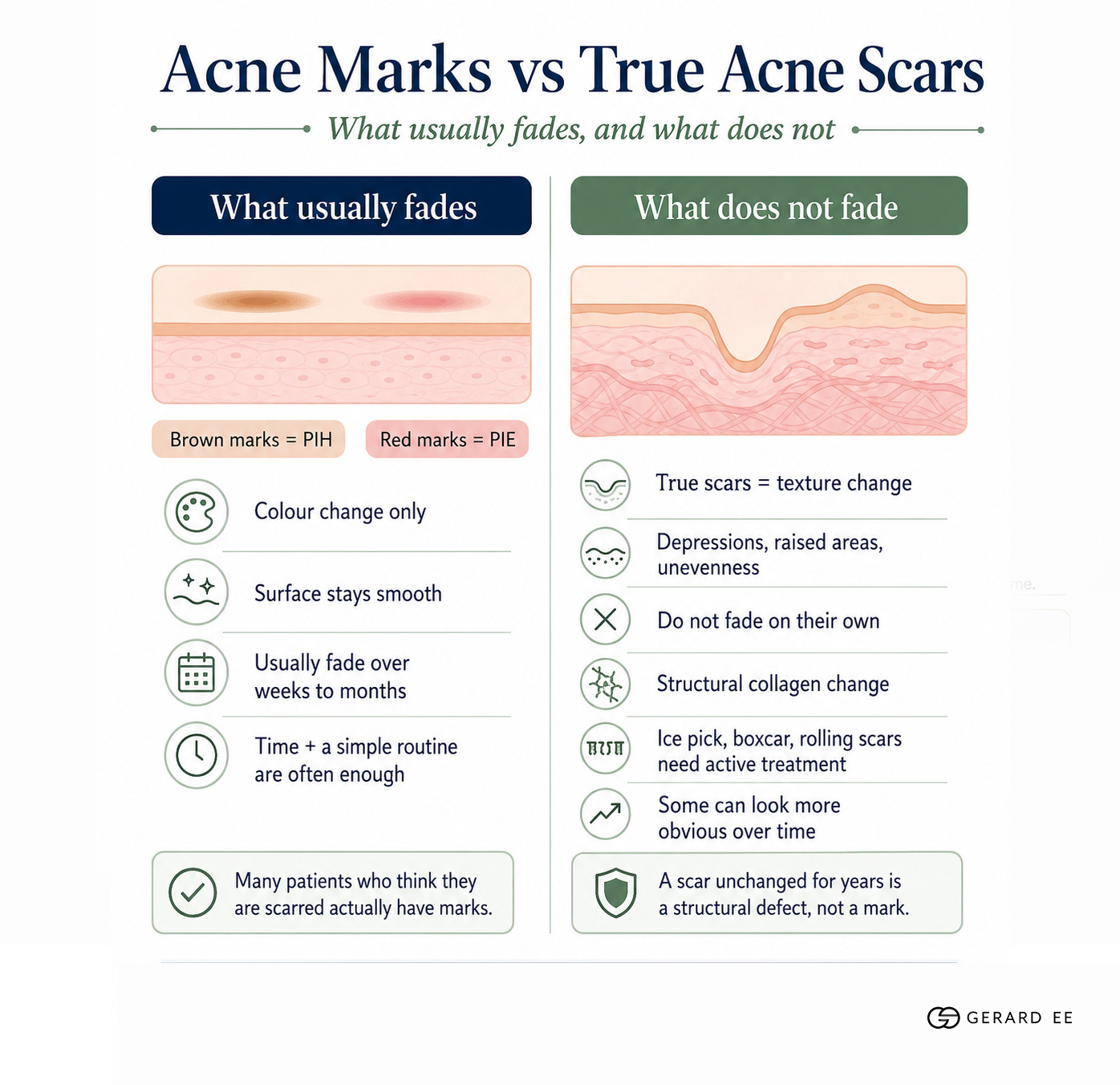 acne marks vs true acne scars acne marks vs true acne scars