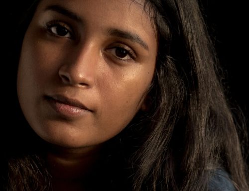 Acne Scar Treatment for Dark Skin