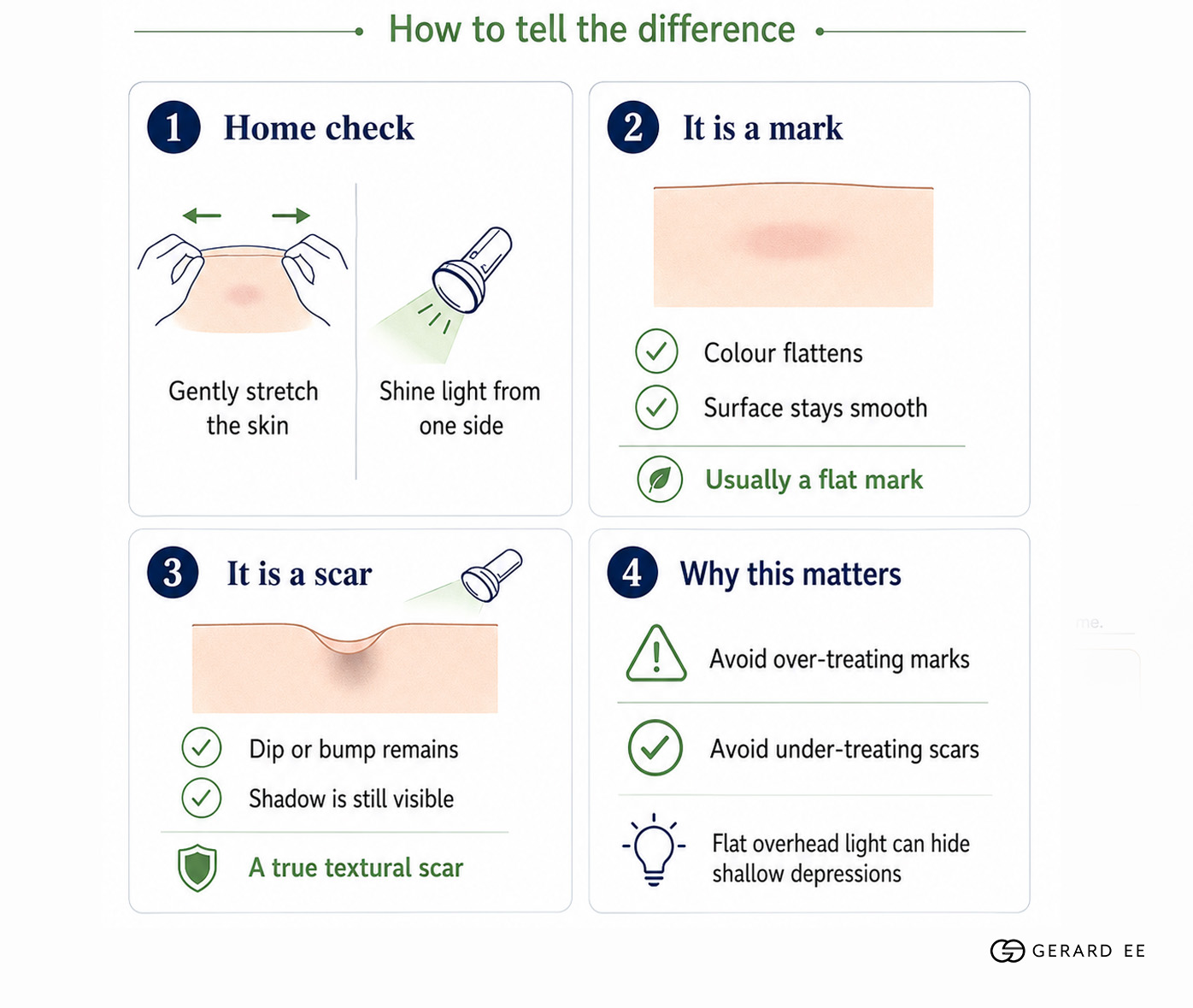 how to tell difference acne scar