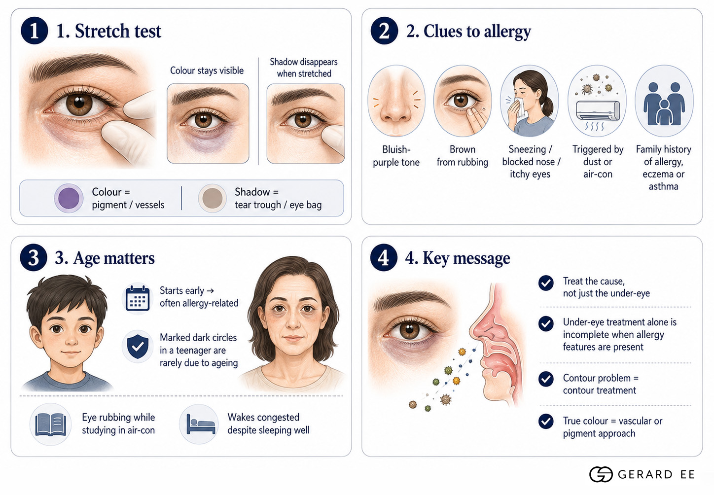 recognise allergy driven dark circles