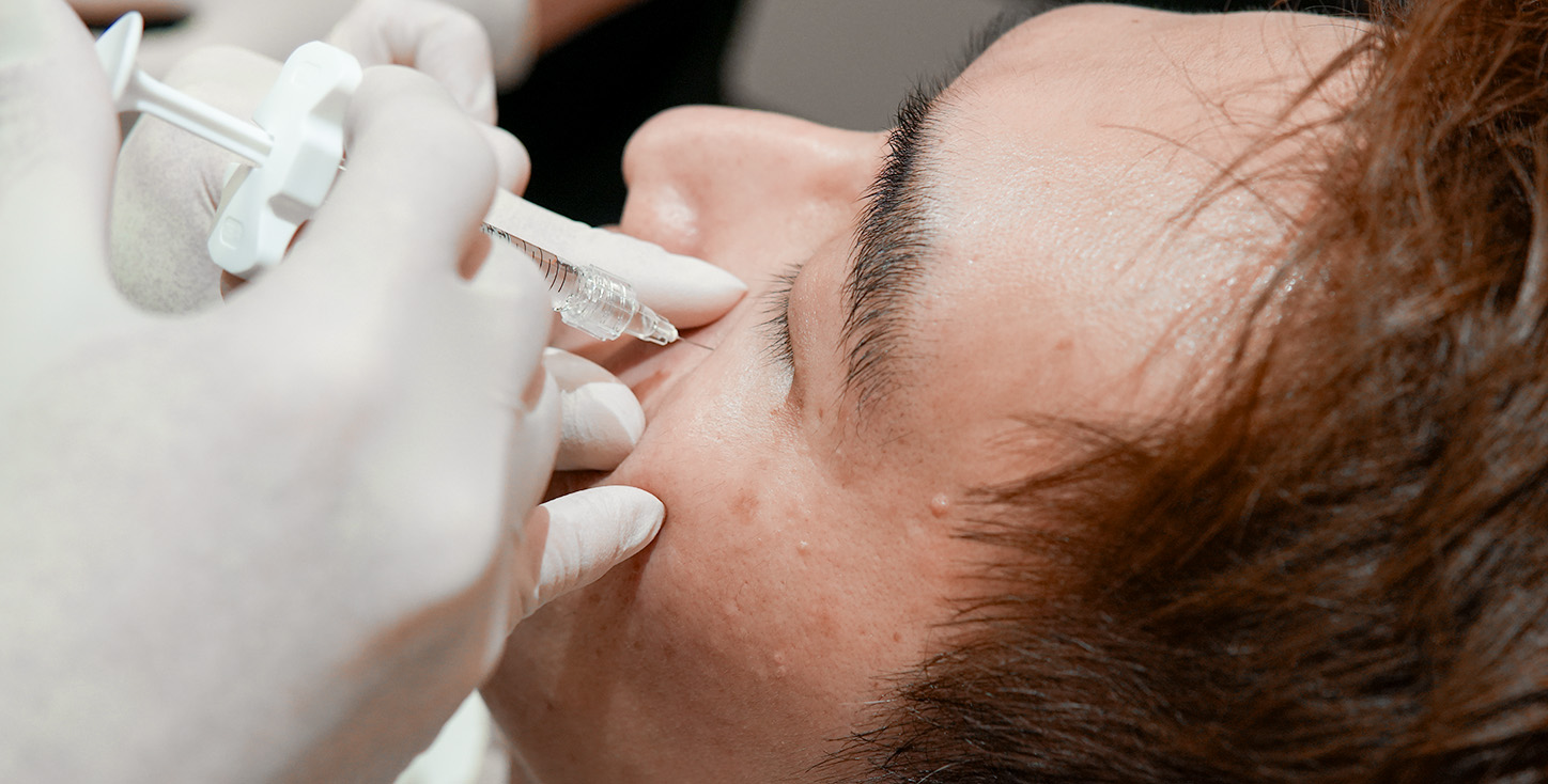 tear trough fillers 2