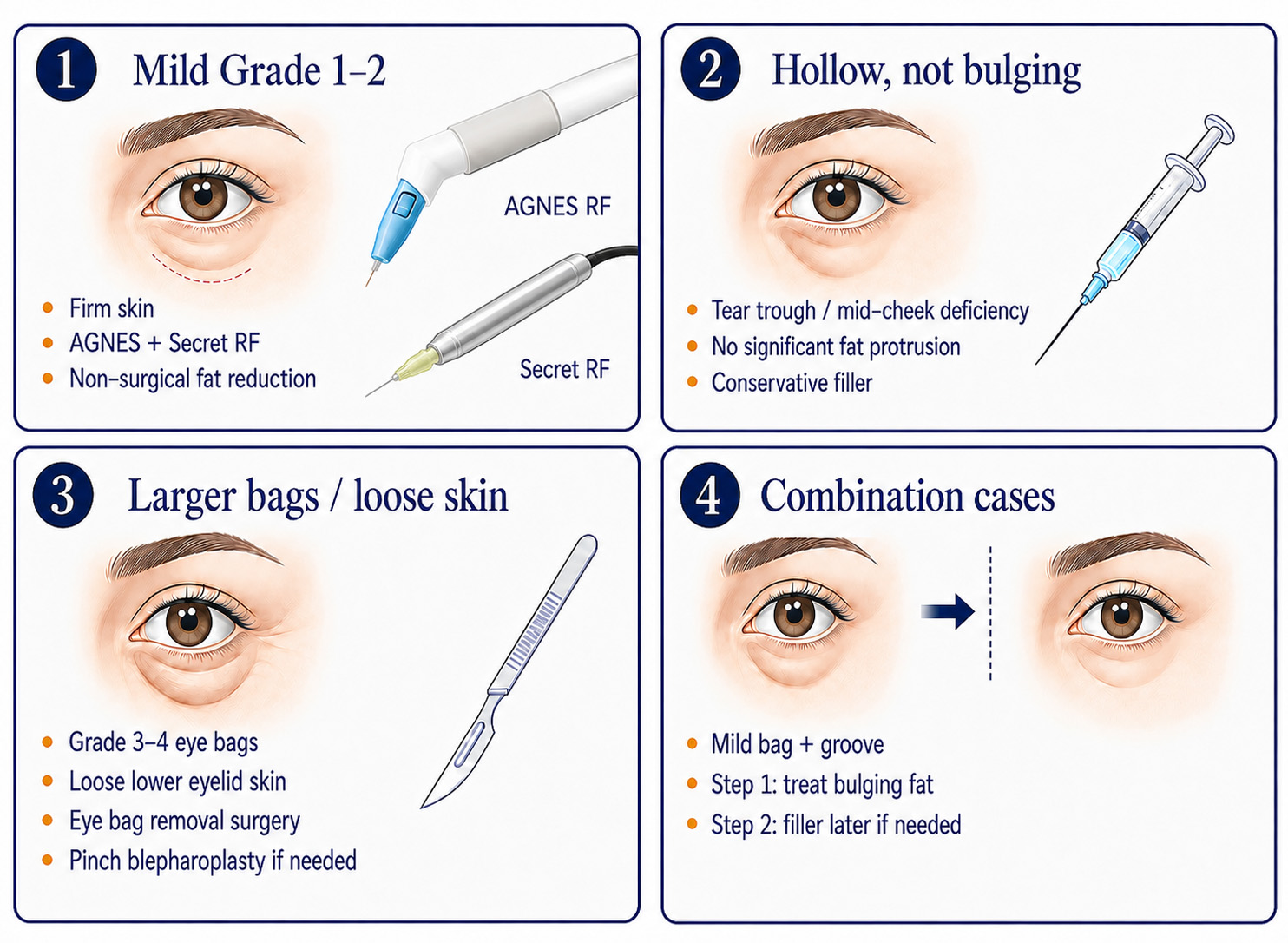 under eye treatment diagram