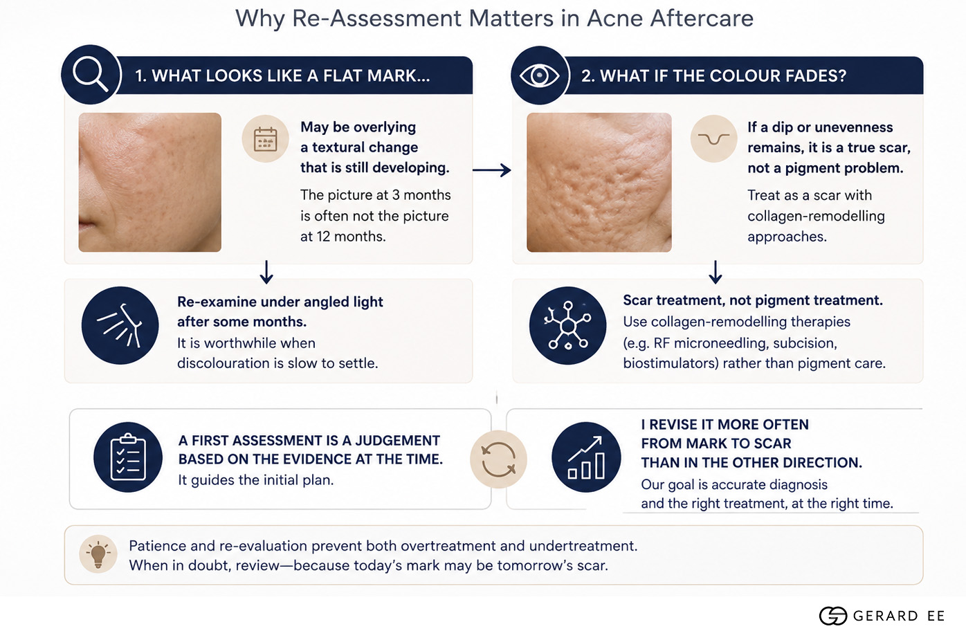 why reassessment matters in acne aftercare