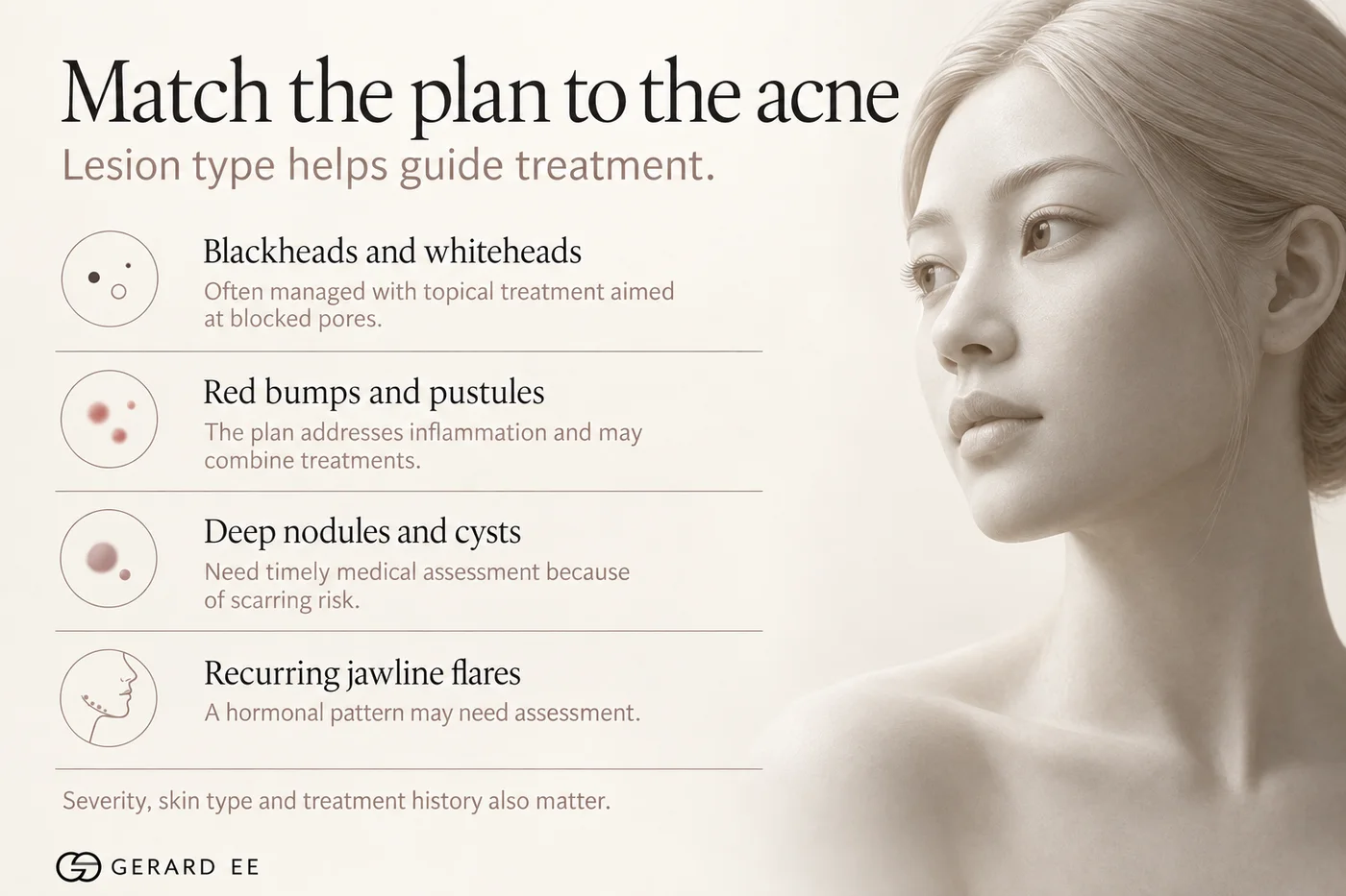 Matching acne treatment to lesion type: blackheads, pustules, nodules and jawline flares