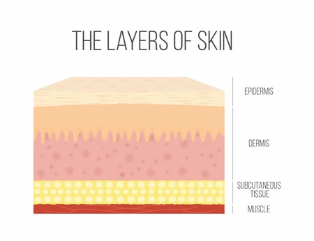 Topical treatment applied to eczema-affected skin