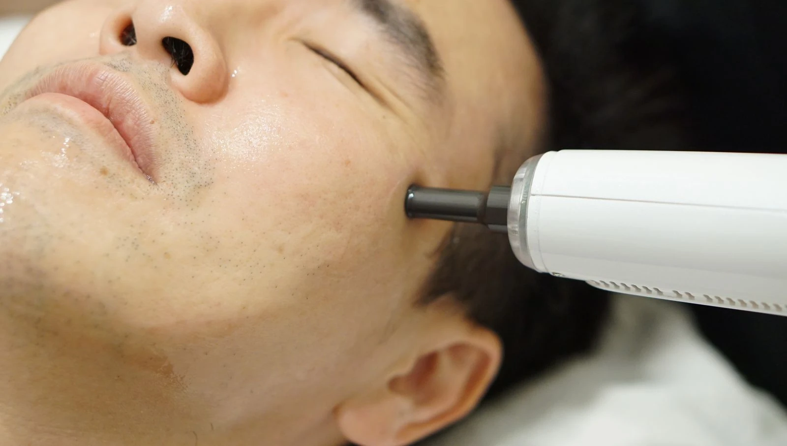 Gold PTT infusion delivered with the Bellasonic handpiece
