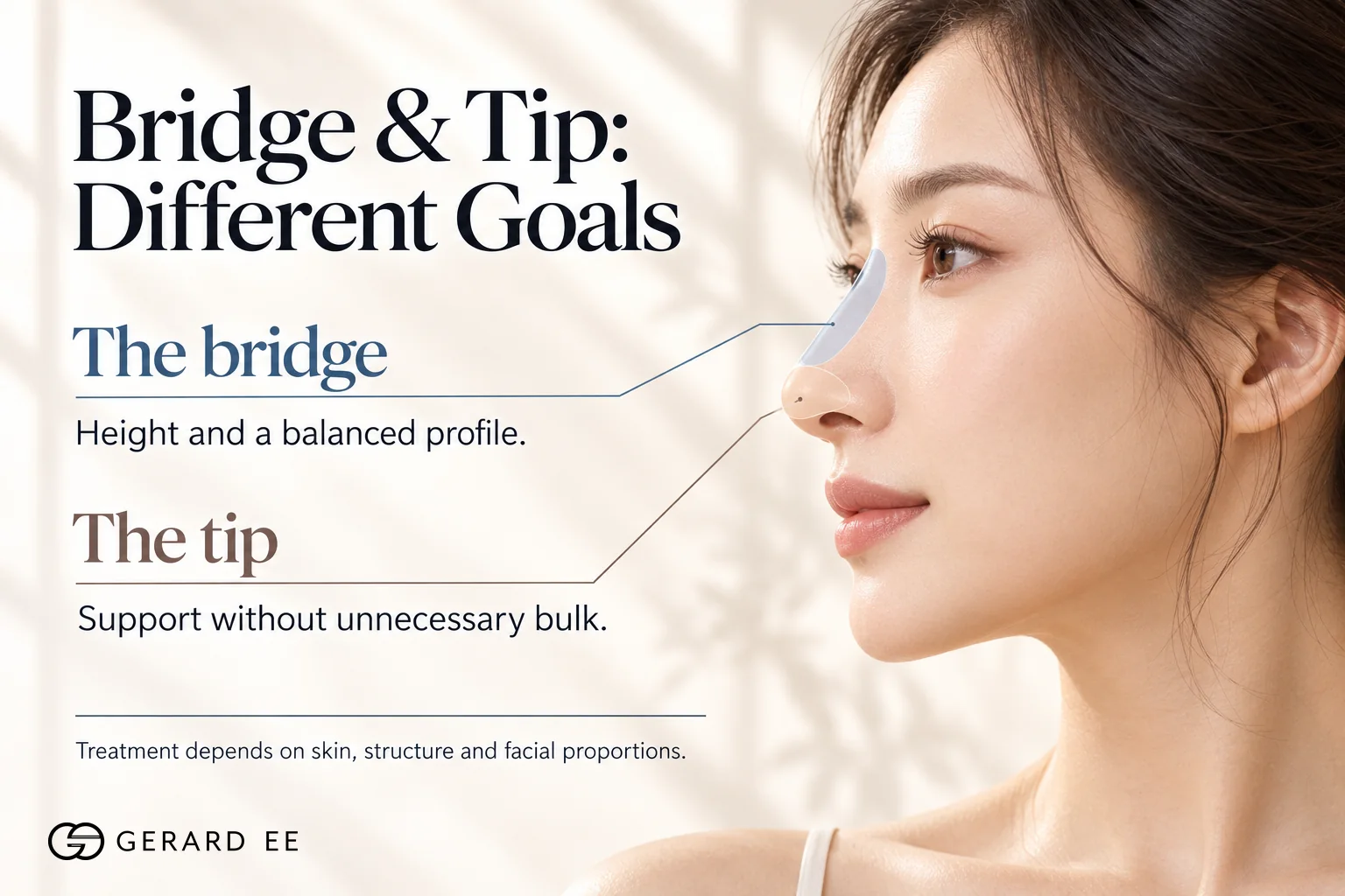Best filler for the nose bridge and the nose tip, height for the bridge and support for the tip