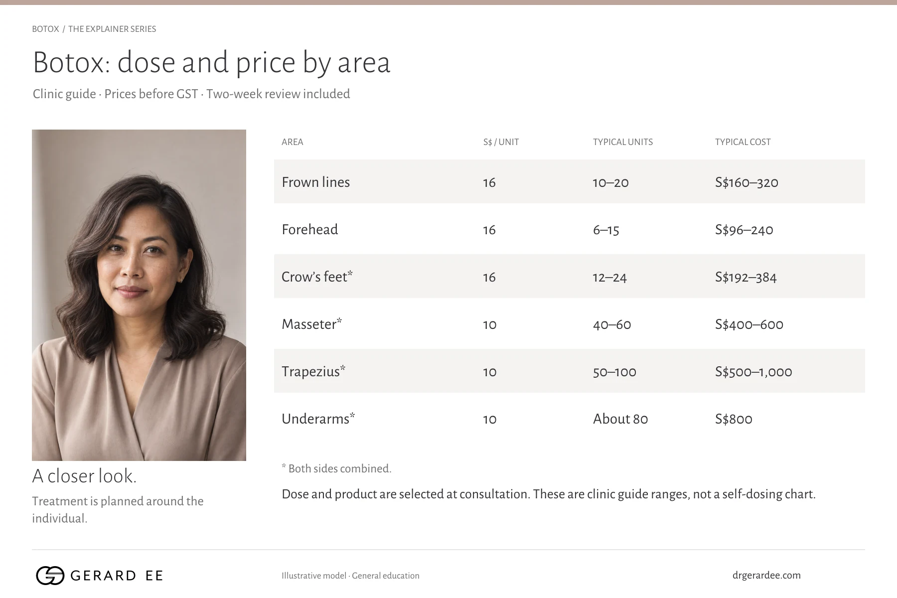 Botox price per unit and typical units by area in Singapore: frown lines, forehead, crow's feet, masseter, trapezius and underarms, before GST