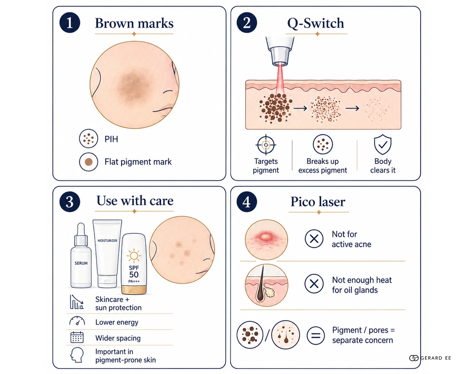 brown marks treatment Treatment for brown acne marks in Asian skin
