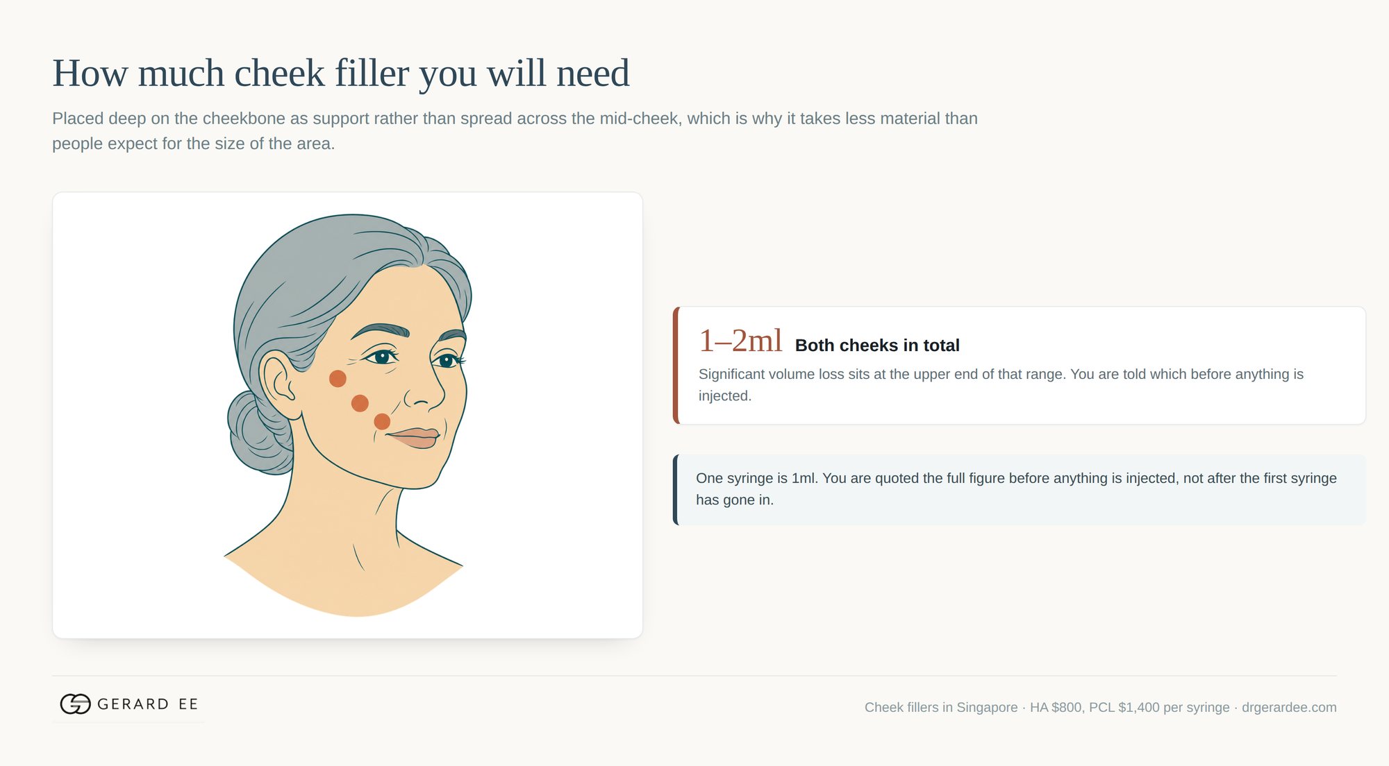How much cheek filler is needed: 1 to 2ml for both cheeks