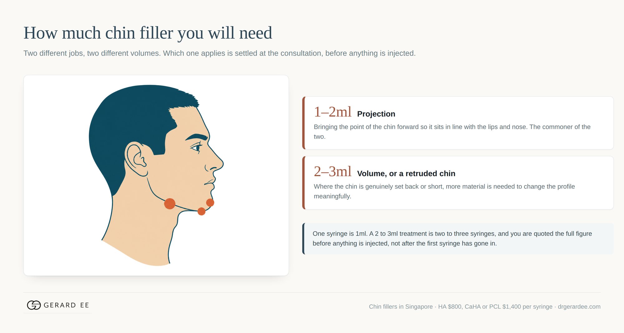 How much chin filler is needed: 1 to 2ml for projection, 2 to 3ml for a retruded chin