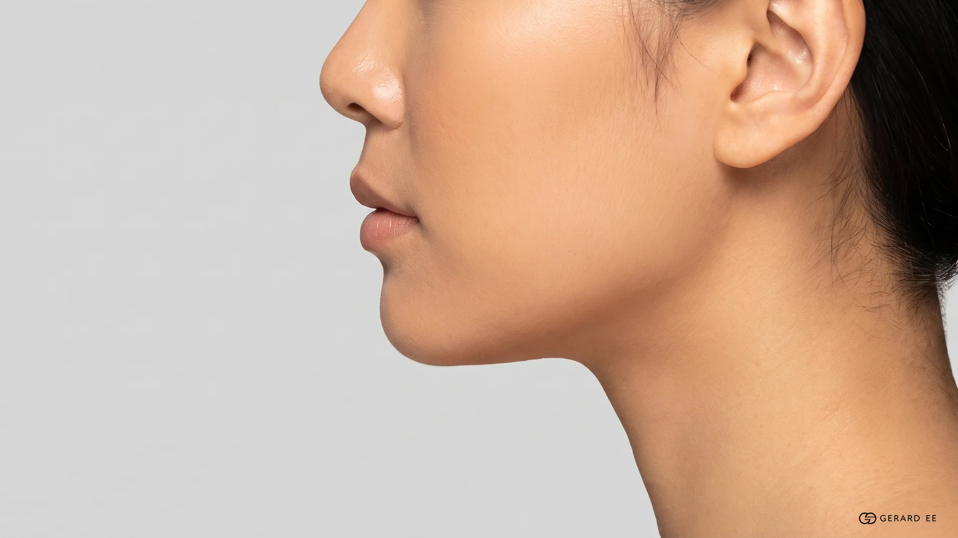 Chin Fillers in Singapore