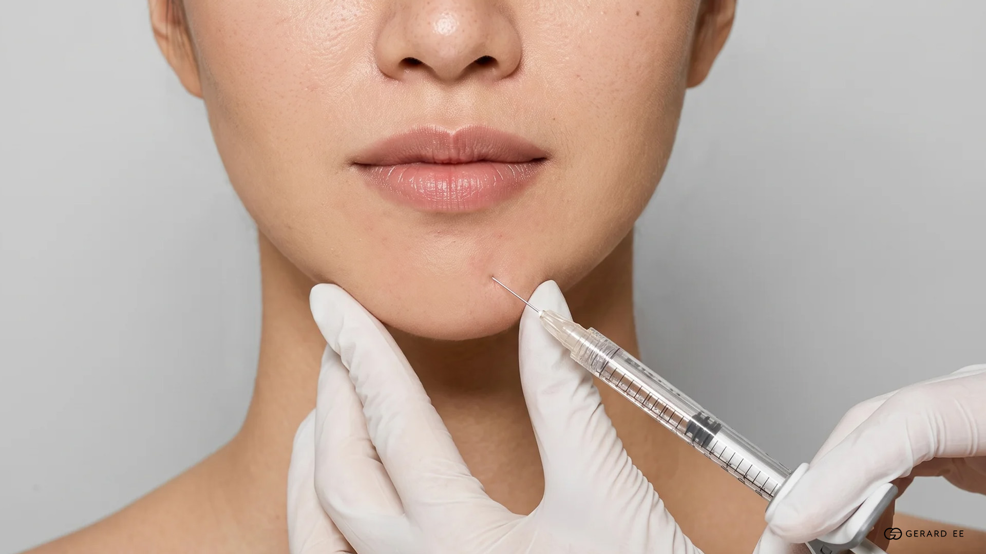 Chin fillers: Which filler is used
