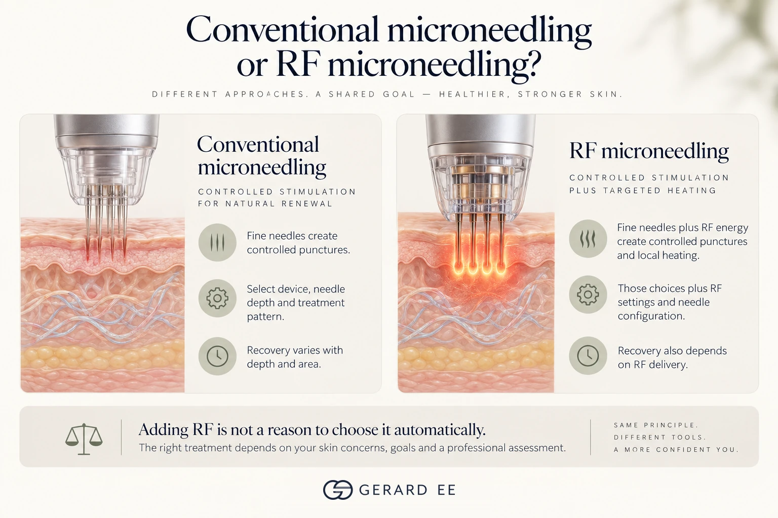 Conventional microneedling compared with RF microneedling: needles alone versus needles with radiofrequency heating in the dermis