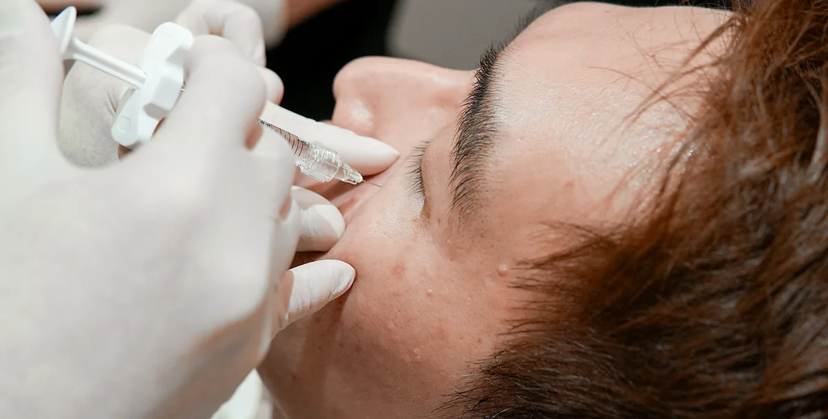 Correcting under-eye filler that has made eye bags worse