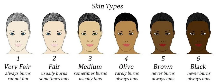 Fitzpatrick skin type chart used before laser treatment on dark skin