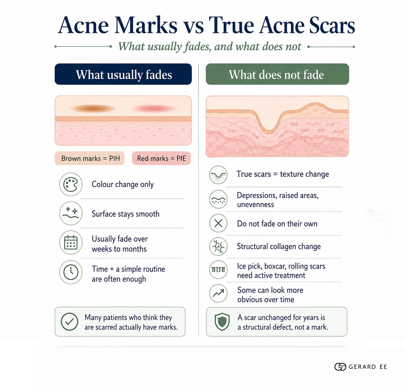 acne marks vs true acne scars Acne marks compared with true acne scars