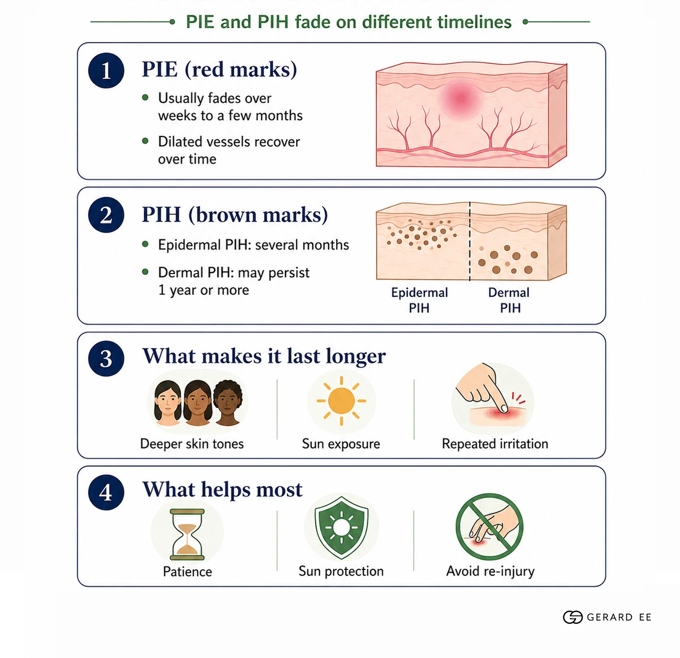 PIE PIH Fade timelines Fade timelines for PIE and PIH acne marks