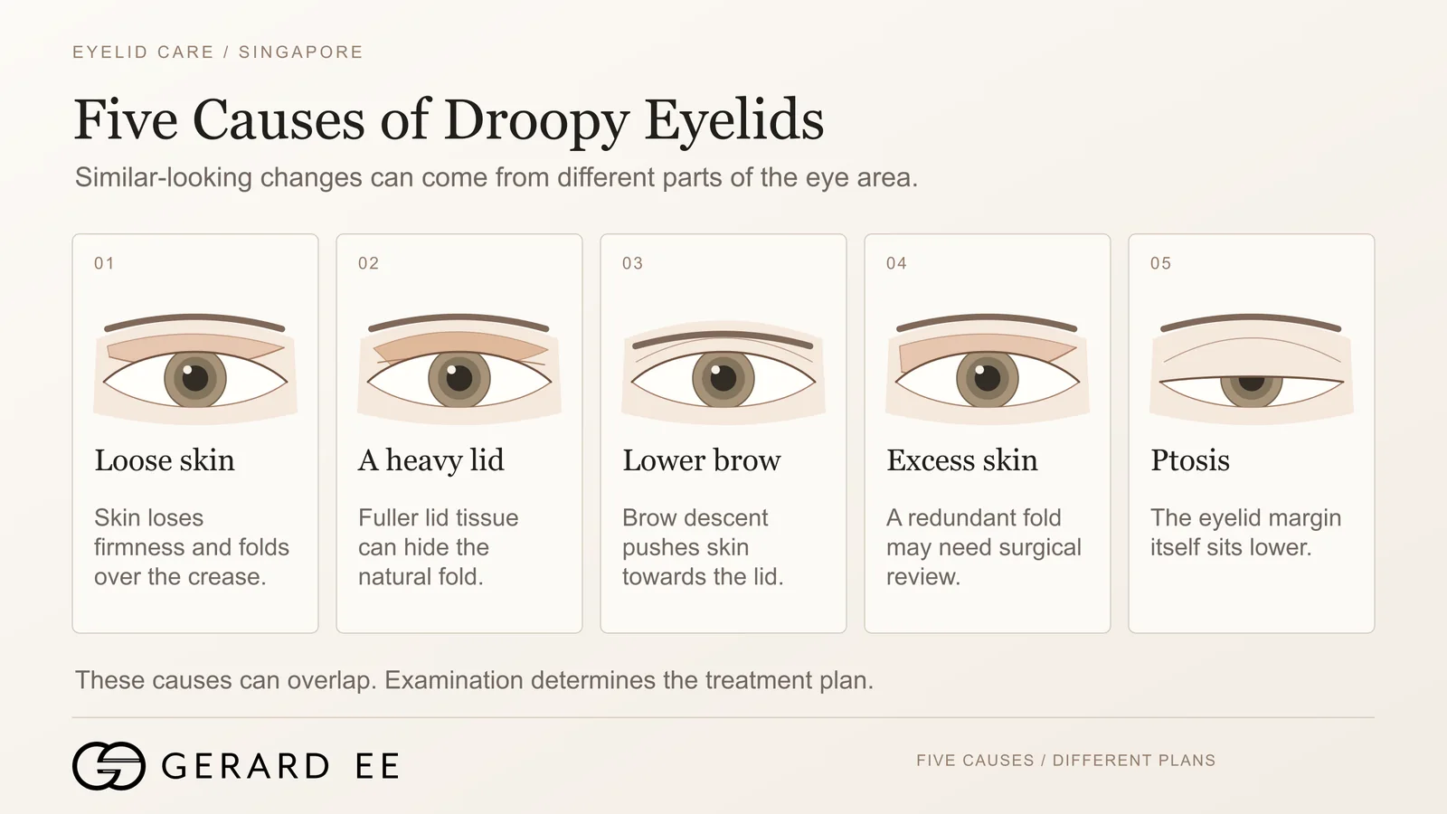 Five causes of droopy eyelids, loose skin, heavy lid, low brow, excess skin and ptosis