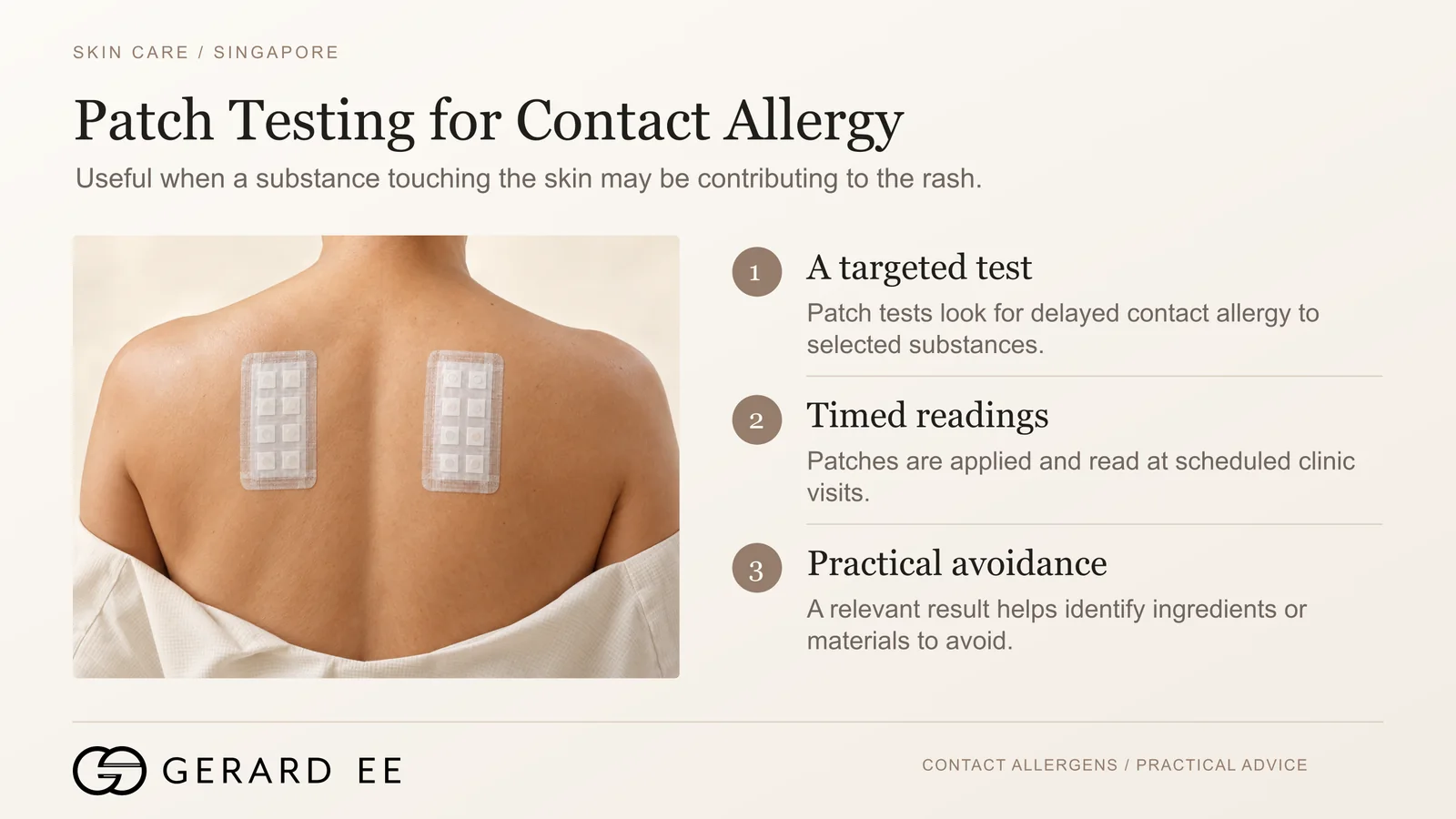 Patch testing for contact allergy as part of eczema treatment in Singapore, allergens applied with timed readings