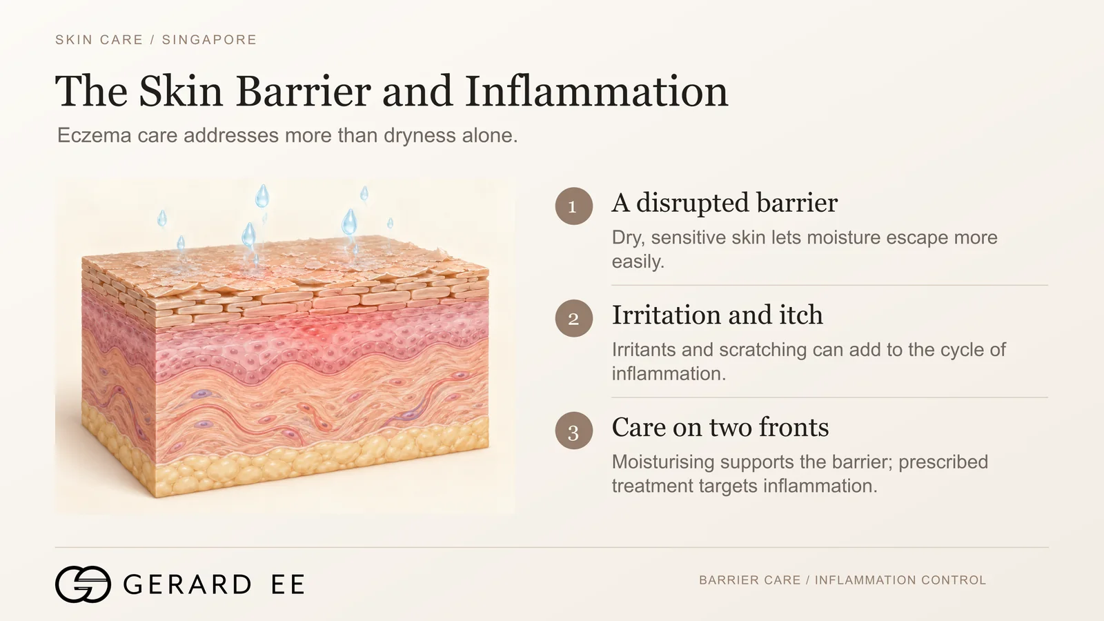 Eczema treatment in Singapore starts with the skin barrier and inflammation, a disrupted barrier, irritation and itch