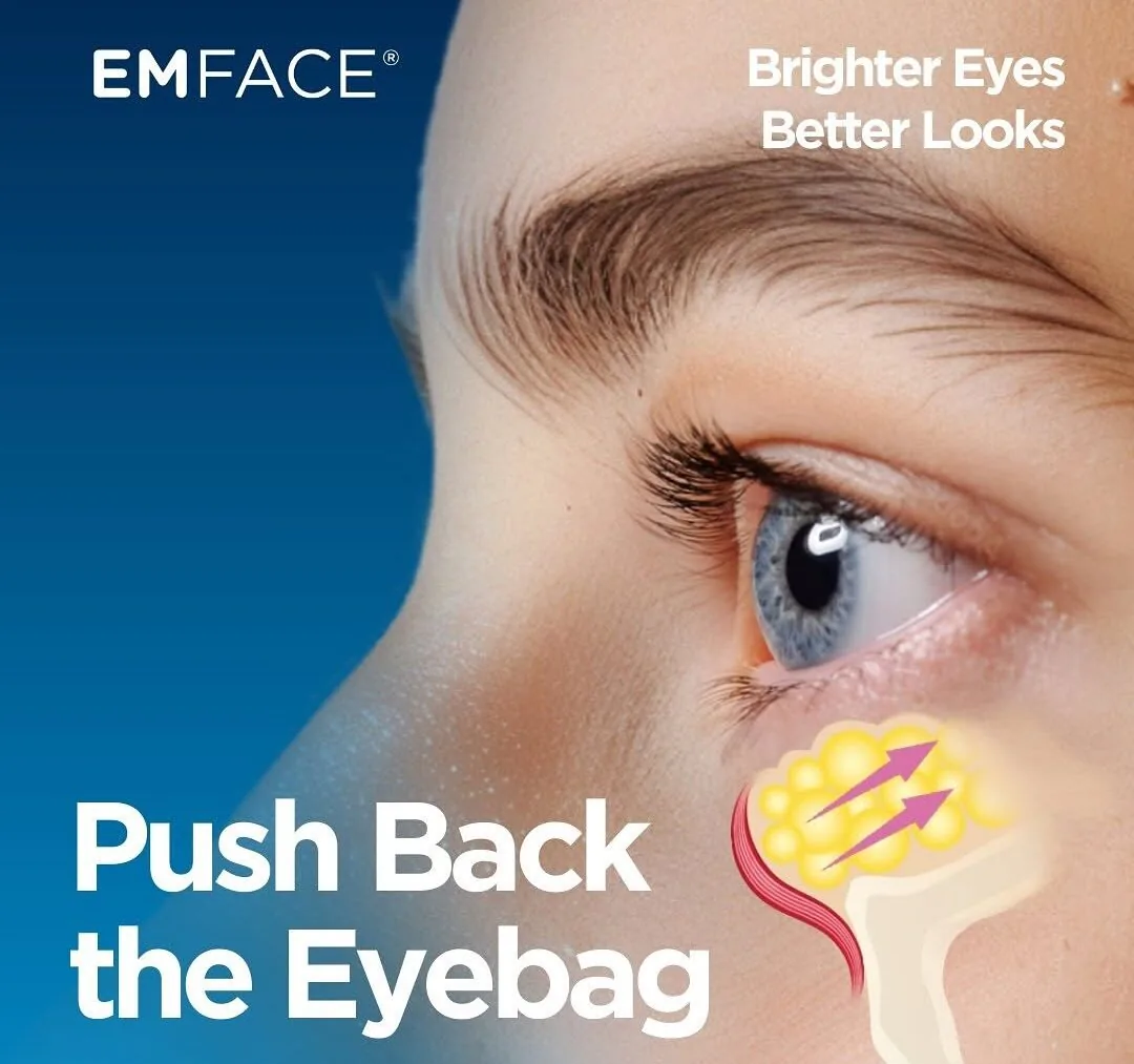EMFACE Eyes manufacturer graphic: radiofrequency and HIFES acting on the lower eyelid muscle and skin