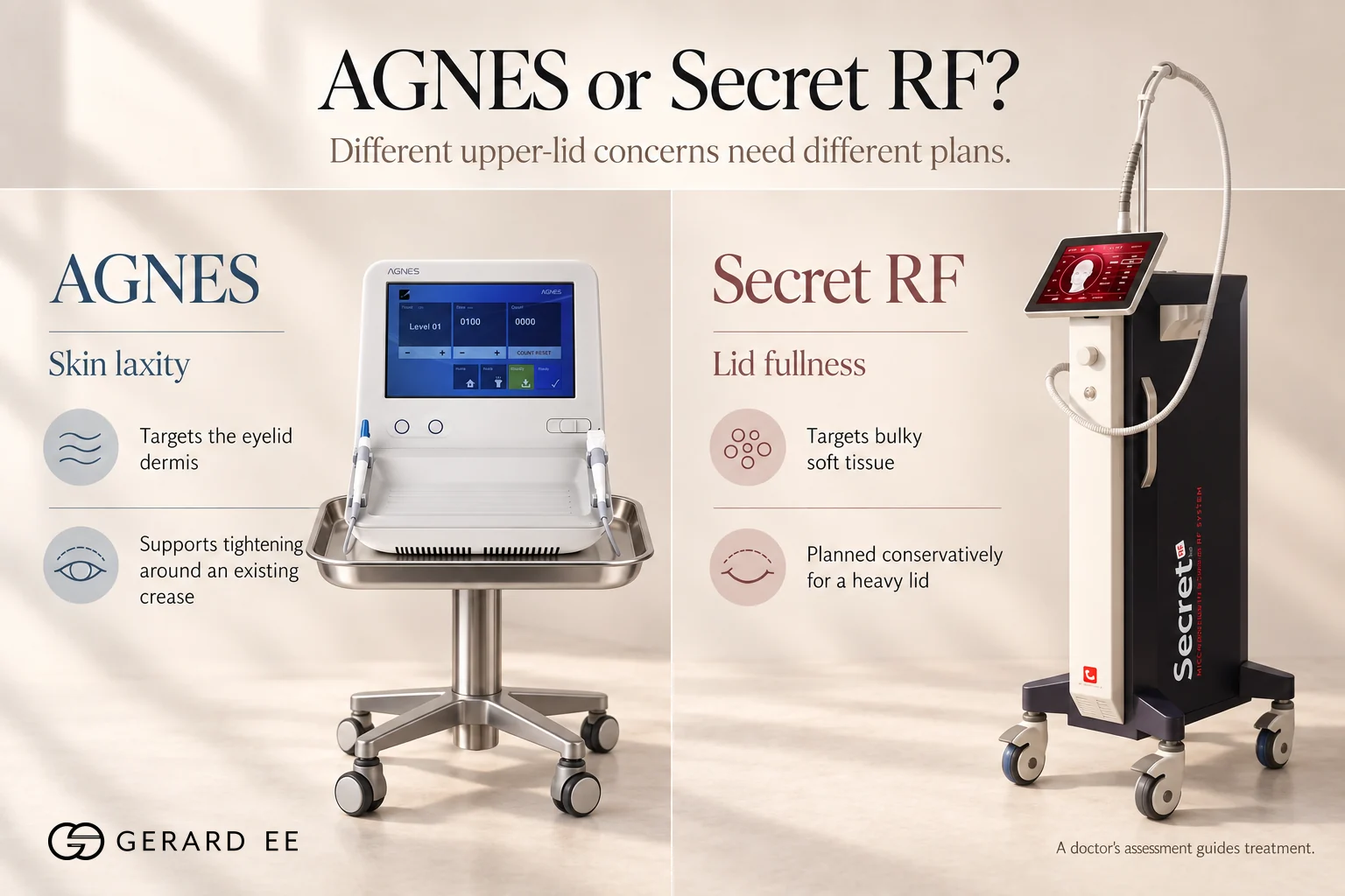 AGNES and Secret RF devices for eyelid lifting, AGNES for eyelid skin laxity and Secret RF for a full heavy lid