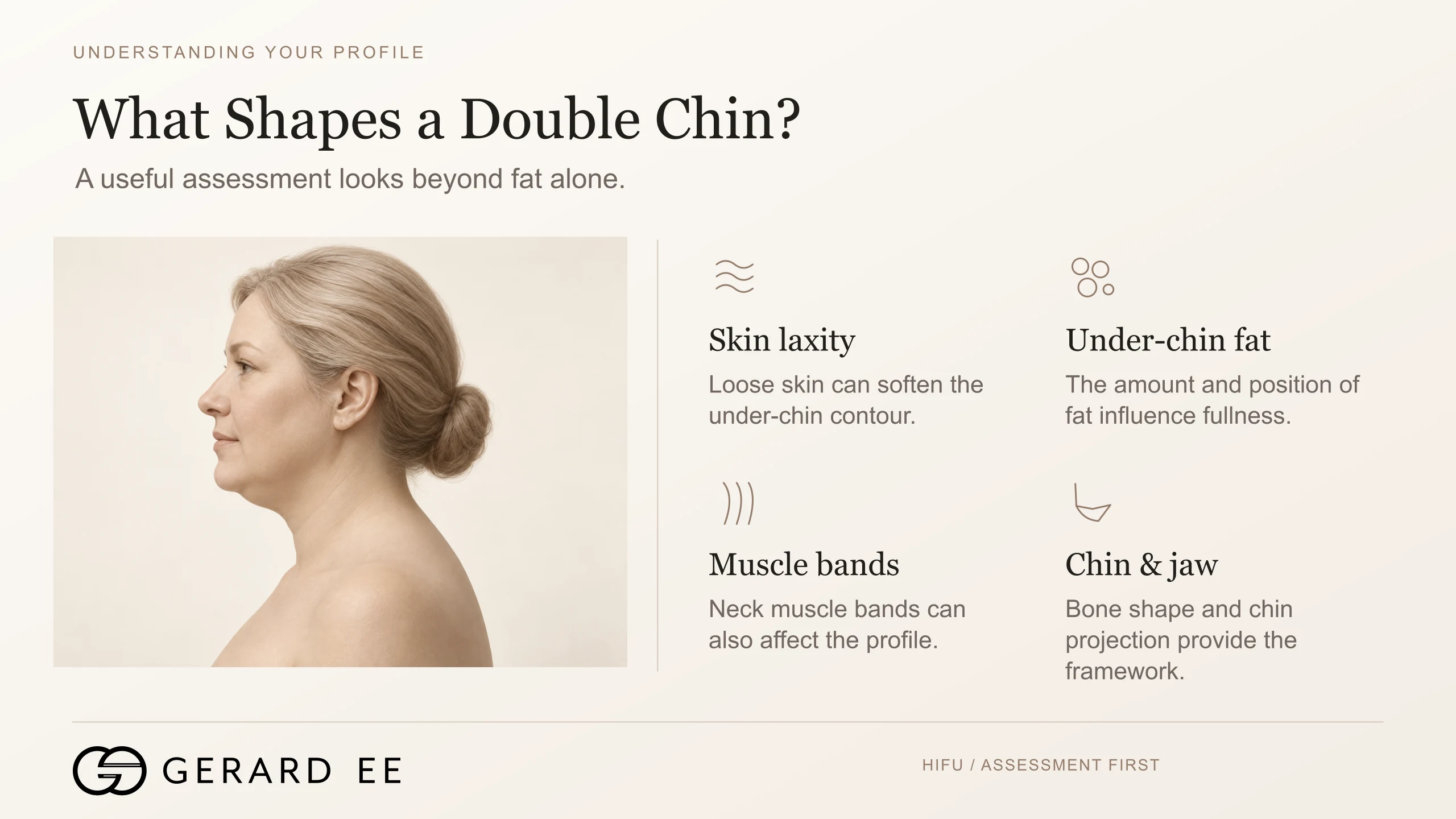 What causes a double chin, skin laxity, under-chin fat, neck muscle bands, and chin and jaw structure