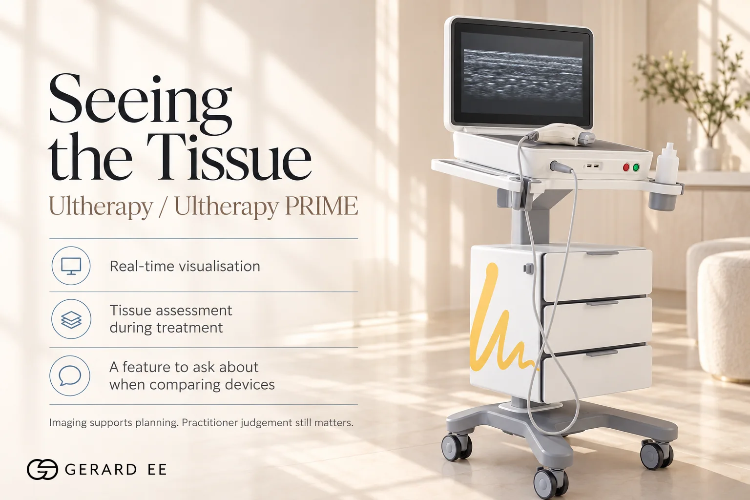 Ultherapy and Ultherapy PRIME HIFU with real-time tissue visualisation