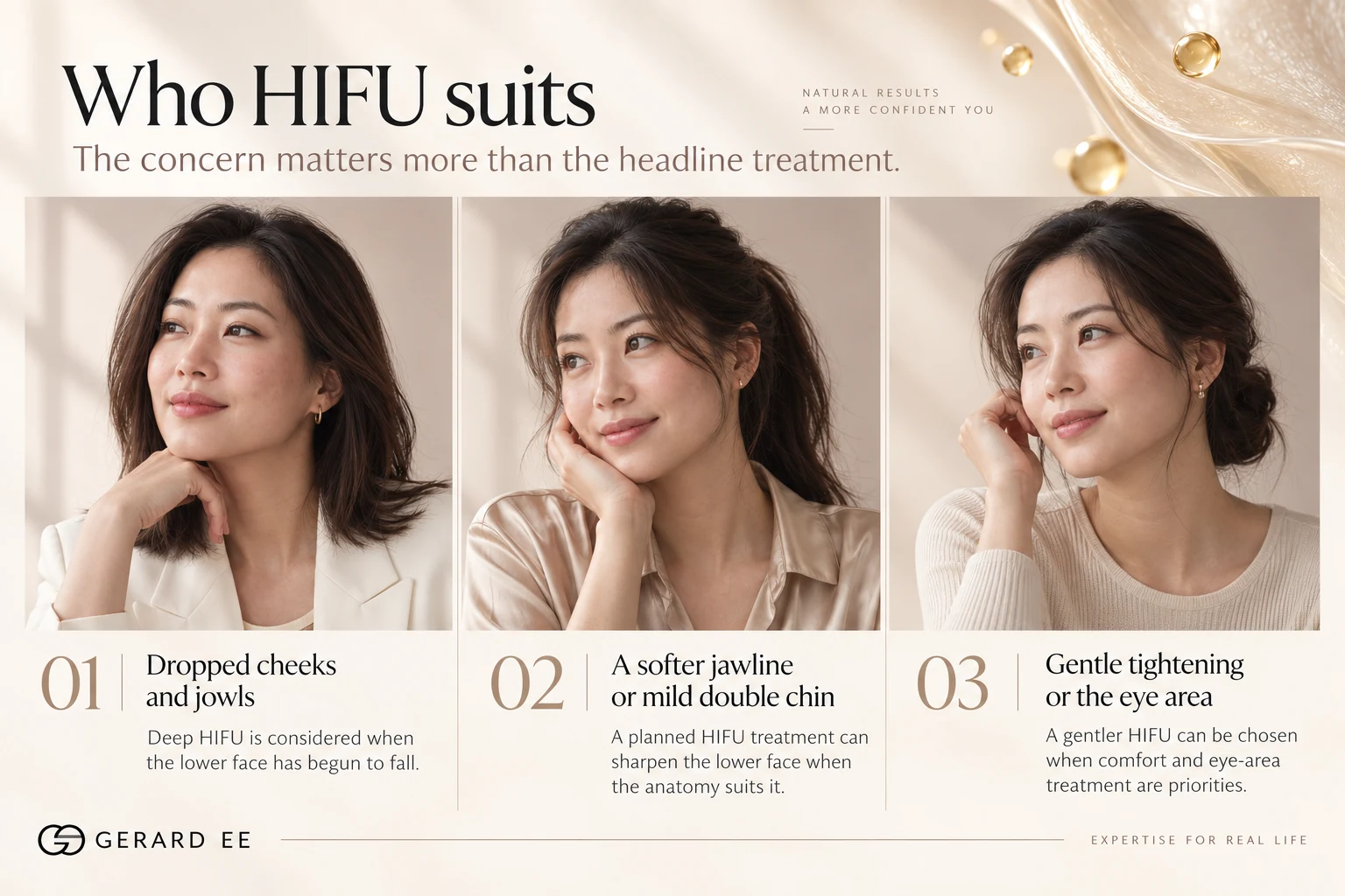 Who HIFU suits in Singapore, mild to moderate sagging of the jawline, jowls and neck