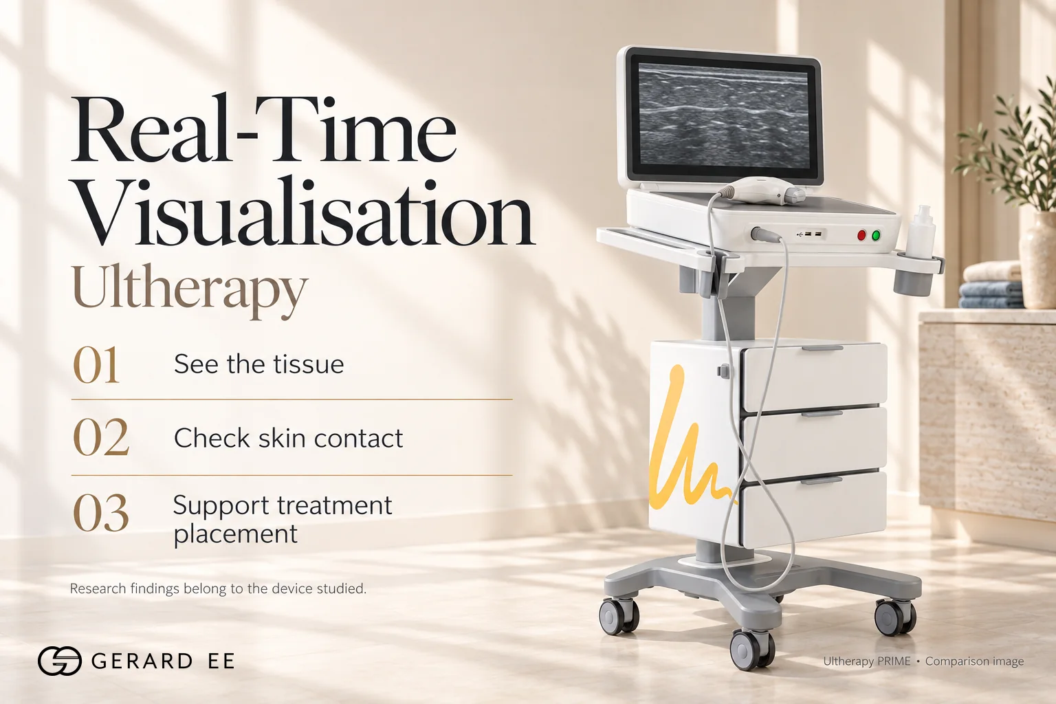 Ultherapy real-time visualisation of the tissue during HIFU treatment