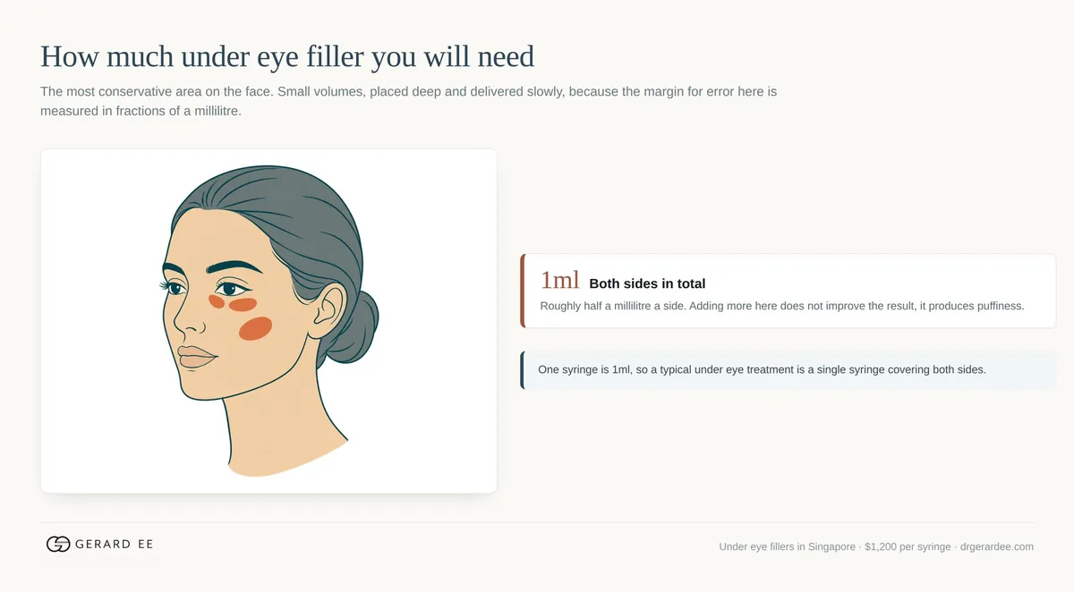 How much under eye filler is needed: 1 ml in total, half a millilitre each side