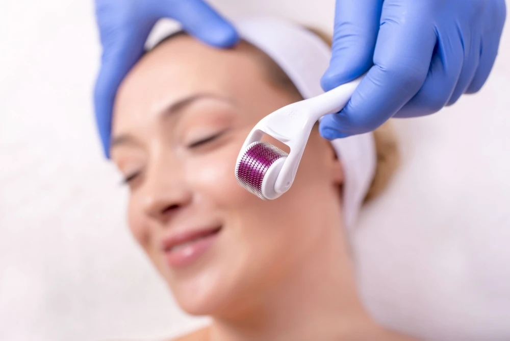 At-home microneedling with a derma roller