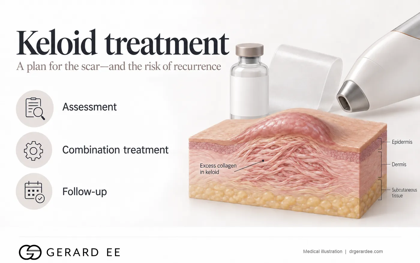 Keloid treatment: a plan for the scar and the risk of recurrence